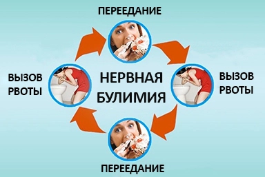 Лечение булимии в Кирове